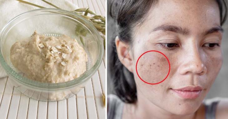 Masque anti imperfections Masque anti imperfections
